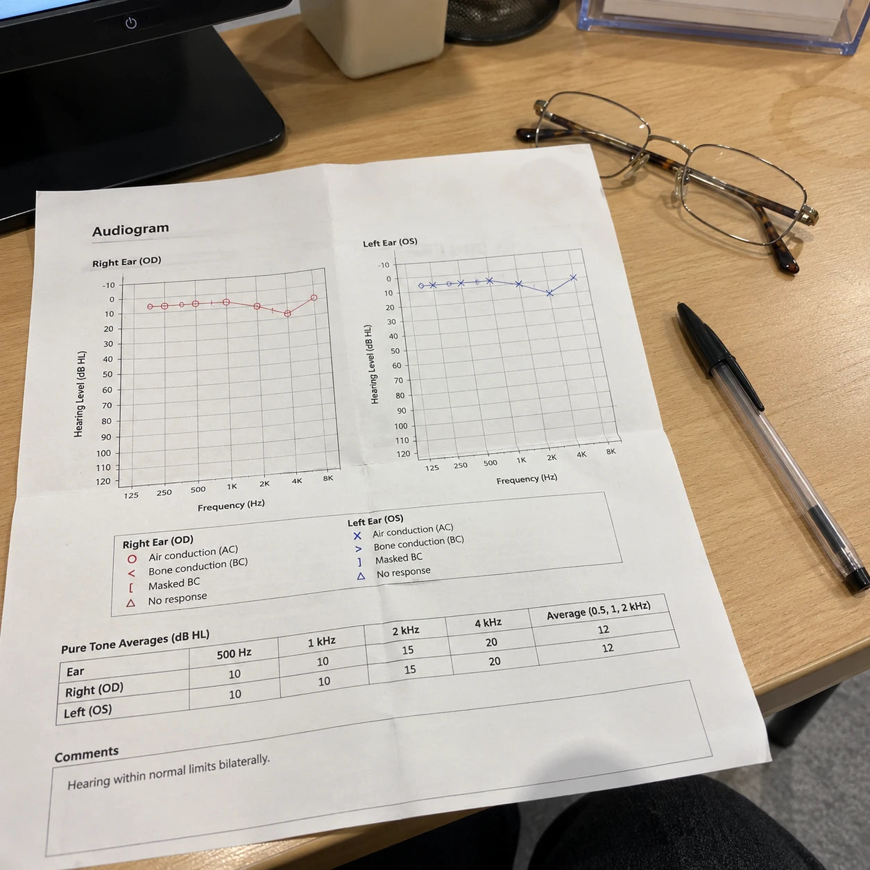 Audiogram results on a clinic desk